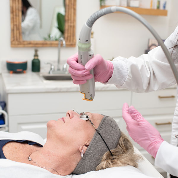 woman receiving facial laser treatment