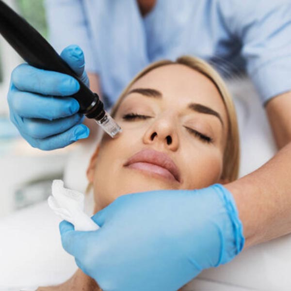 woman receiving microneedling treatment