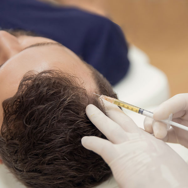 man receiving hairline injection