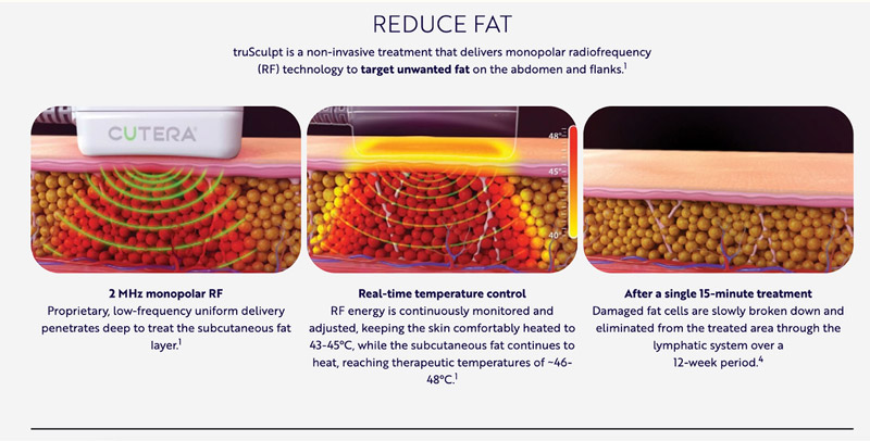 Reduce Fat